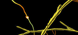 69806b44476bf-69087666689cf-brain_508_tiff.jpg *TEST STRIP*
